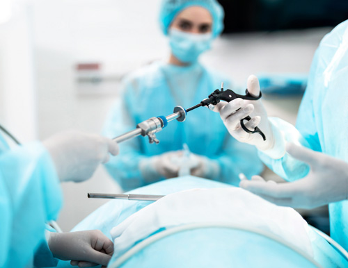 Laparoscopy Diagnostic